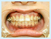 Photo: 予防歯科